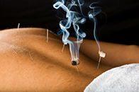 moxabustion on a person's back